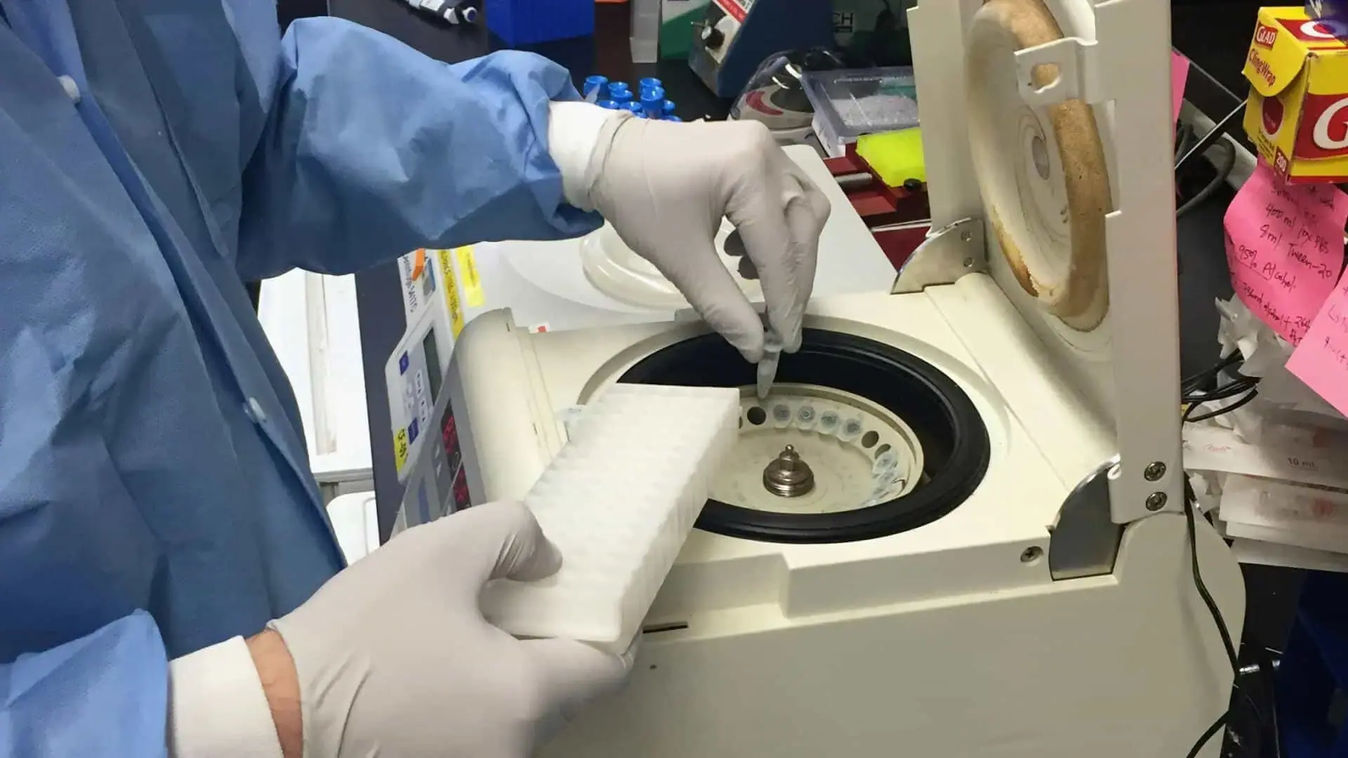 Types of Laboratory Centrifuges